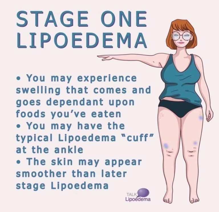 About Lipoedema