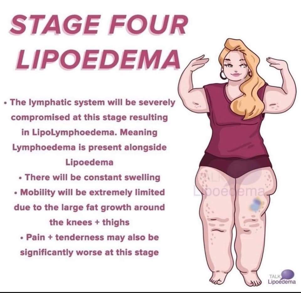 About Lipoedema